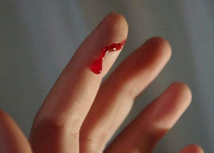 Nằm mơ thấy dao cắt đứt tay chảy máu